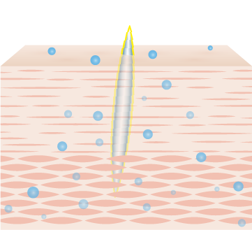 Mechanism Step